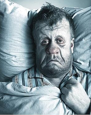 flu face