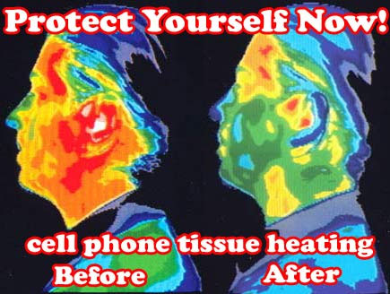 mobile phone tissue heating