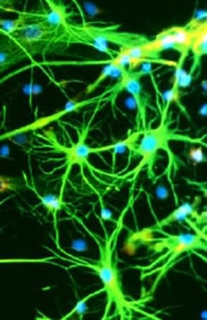 nano deeltjes tussen zenuwcellen Foto van een electronenmicroscoop. Nanodeeltjes die zich in de hersenen bevinden (Bron: Jim Giles/ Nature.com)