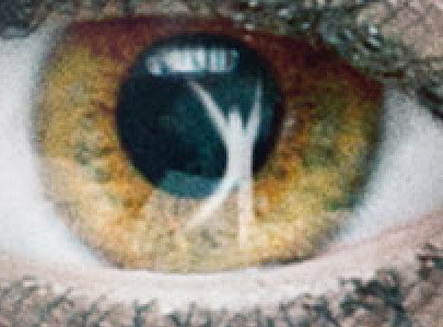 eye Thrive