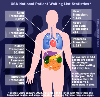 organ-transplant-statistic1